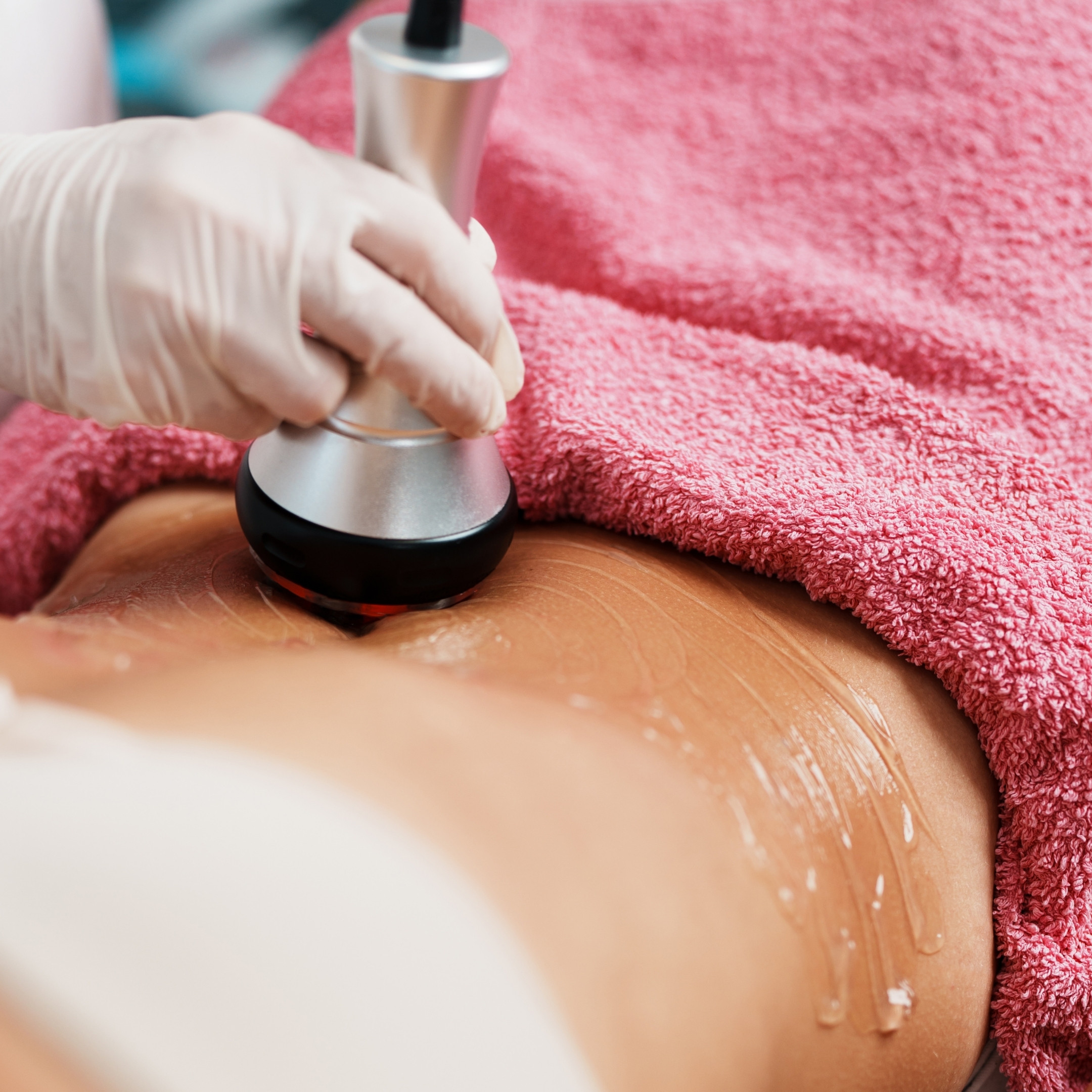 Kavitációs zsírbontó kezelés hasi területen a SHAPE HAUS-ban