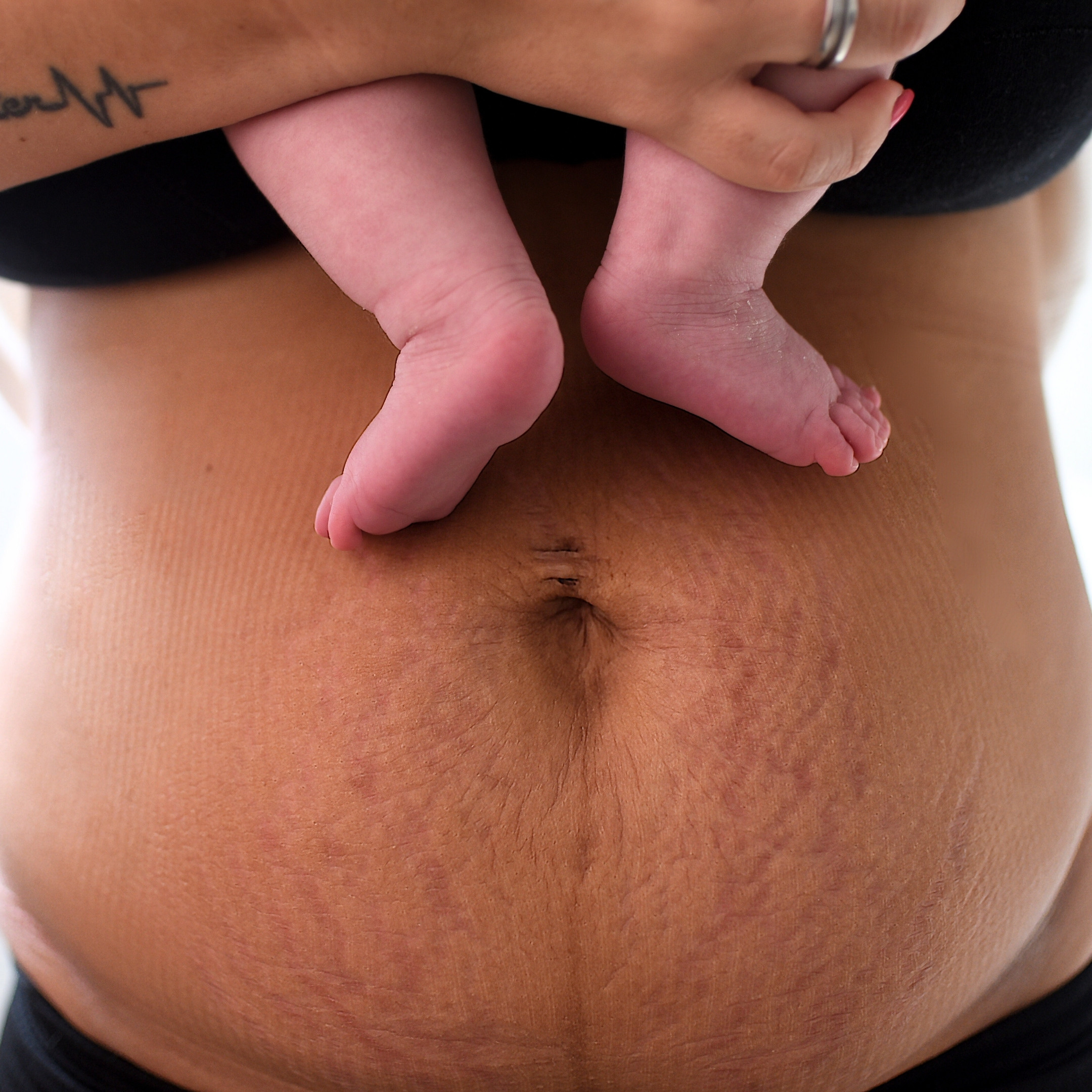 Szülés utáni hasi változás természetes női testképen